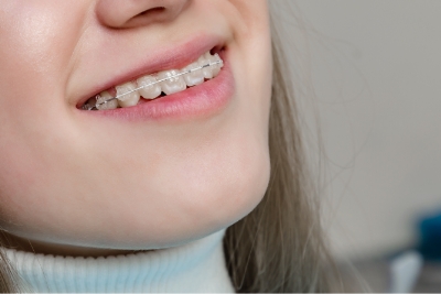 子供だからこそ可能な矯正治療で、美しい歯並び、正しく噛み合わせるために早い段階から矯正治療を受けることが大切